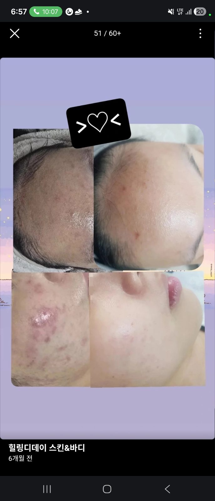 힐링디데이스킨&바디 스타일